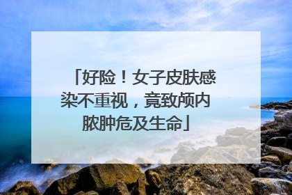 好险！女子皮肤感染不重视，竟致颅内脓肿危及生命